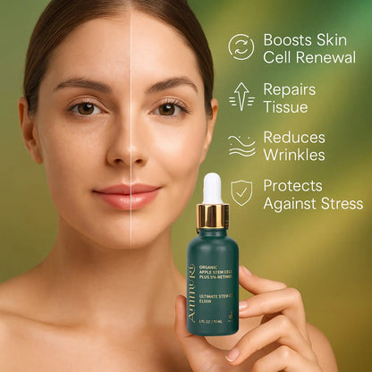 Ammuri Retinol 5% Serum with Apple Stem Cell – High Strength Anti-Aging, Acne & Dark Spot Treatment (30ml)